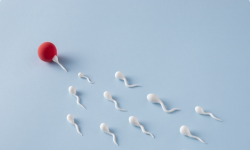 Male Infertility
